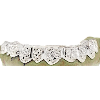 Grillz Diamond Dust Grill G0065 - Mr. Goldman & Sons
