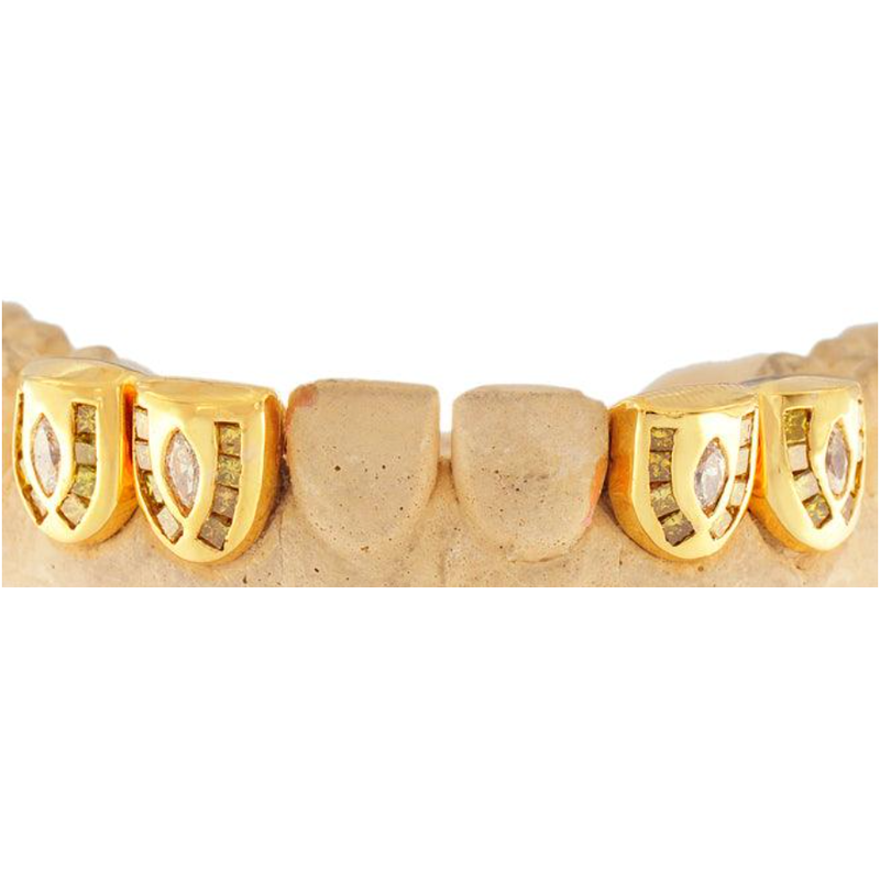 Grillz individual channel set diamond grill G0040 - Mr. Goldman & Sons